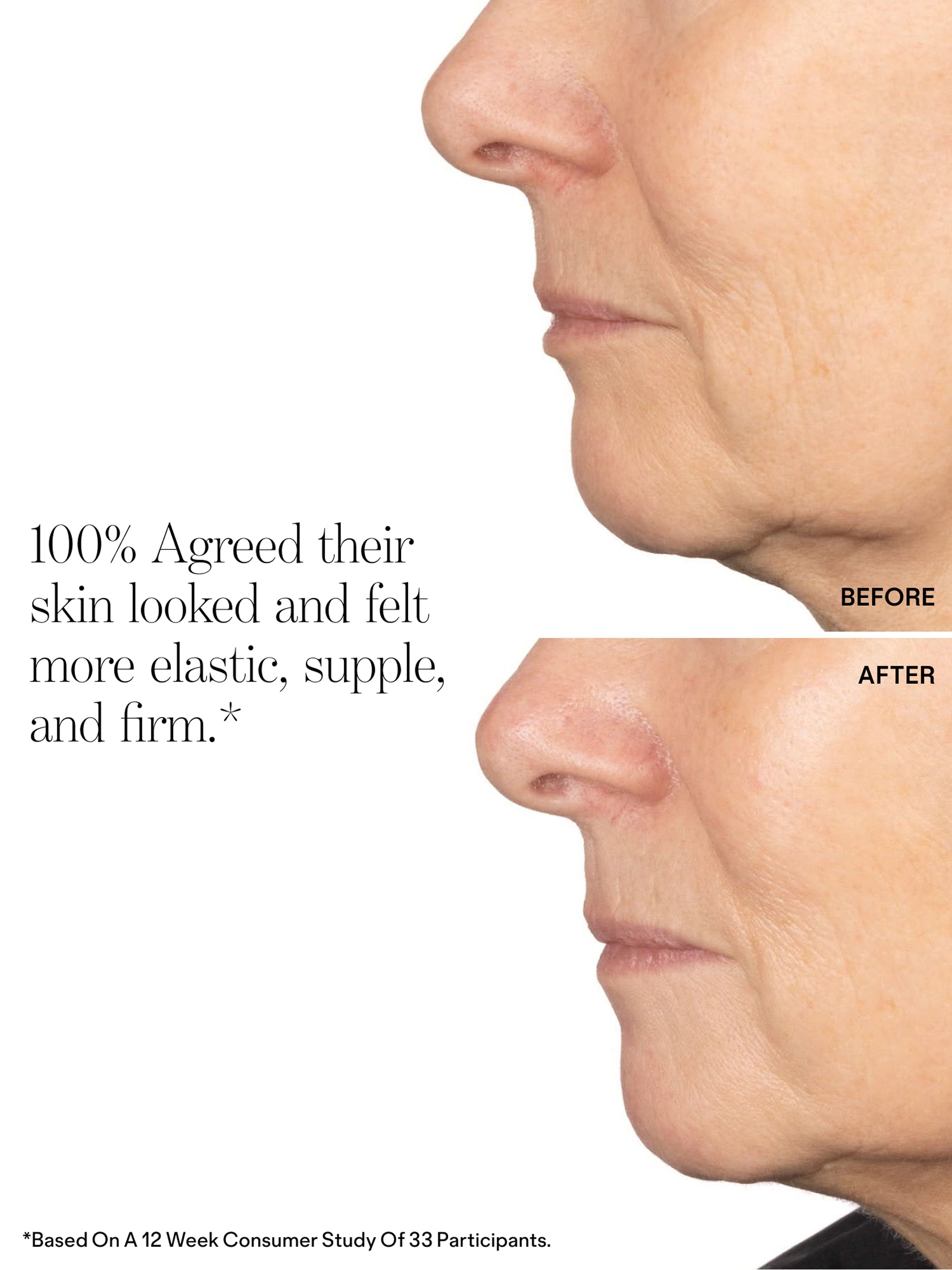 Very Amazing Retinal