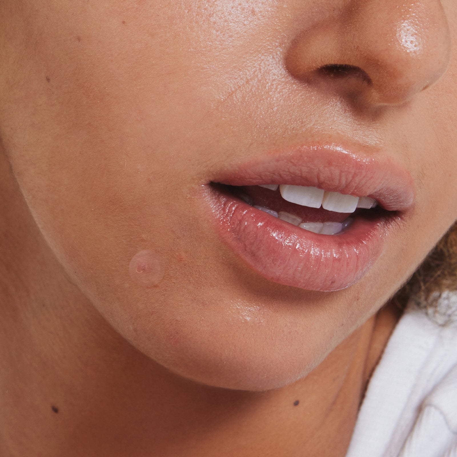 Spot Stoppas Pimple Patch Go-To Skincare