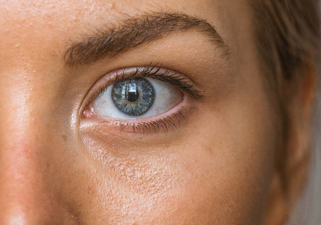 How To Treat Milia | Go-To Guide | Go-To Skin Care