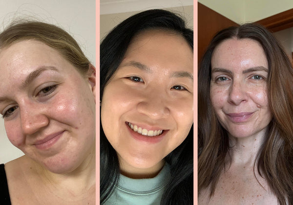 How Much Plumper Skin Works For Different Skin Types