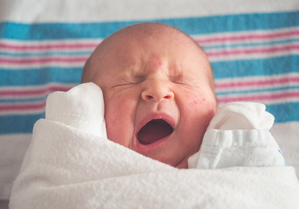 Dr Golly says newborn acne is completely normal.