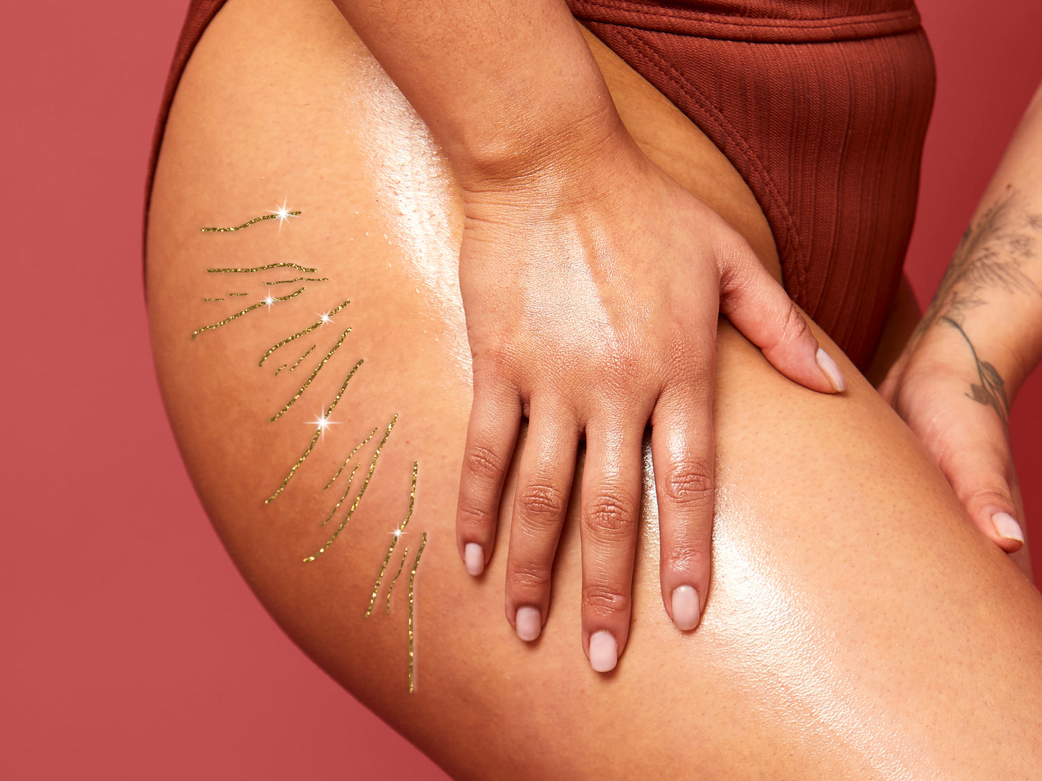 Everything You Need To Know About Stretch Marks