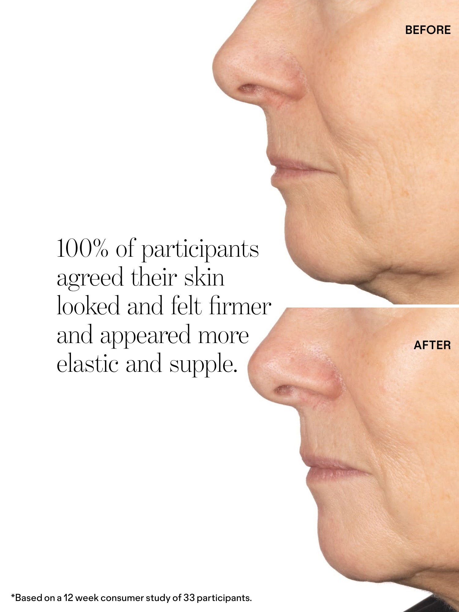 Very Amazing Retinal